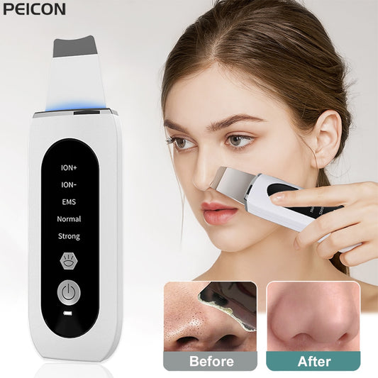 Ultrasonic Skin Scrubber Peeling Blackhead Remover Deep Face Cleaning Ultrasonic Ion Ance Pore Cleaner Facial Shovel Cleanser - dabarey